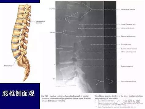 骶尾椎侧位x线解剖图 千图网