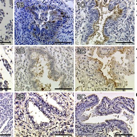 Expression Of Mucin 1 Muc1 In Endometrial Glandular Epithelial Tissue