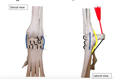 Diagram Of Ligaments Of Carpus Quizlet