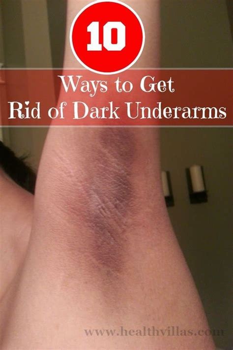 10 Ways To Get Rid Of Dark Underarms Lichaamsverzorging Bodyscrub En Huidverzorging