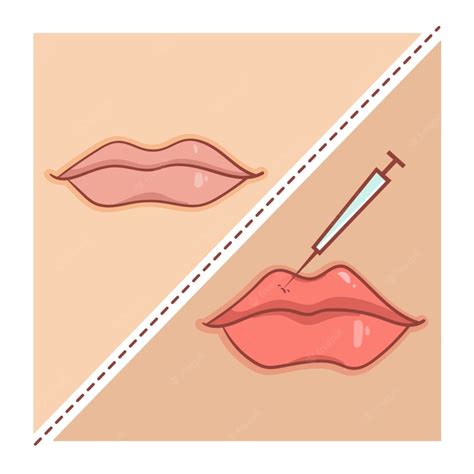 How To Massage Lip Filler Lumps A Complete Guide The Daily Glimmer