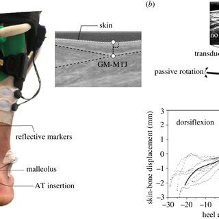 Experimental setup for the measurement of the Achilles tendon (AT)... | Download Scientific Diagram