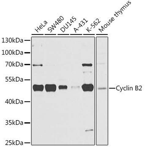 Anti Cyclin B2 抗体 Cab3351 Assay Genie