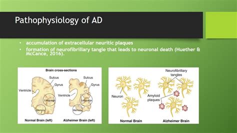 Alzheimer's Disease: Causes and Treatment - 1113 Words | Presentation ...