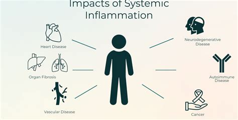 What Is Inflammation The Center For Inflammation Science And Systems