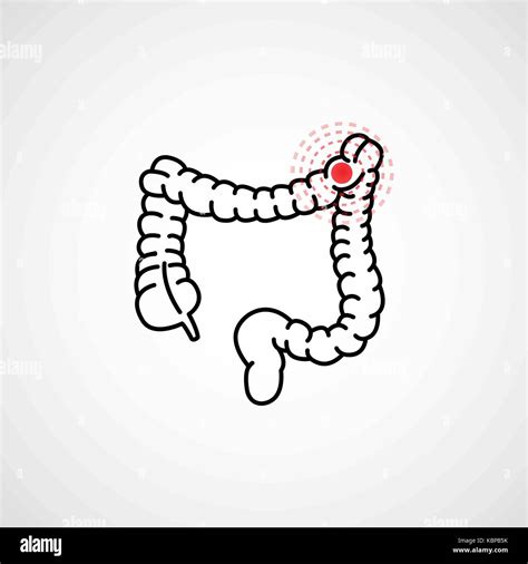 Colon Cancer Vector Logo Icon Illustration Stock Vector Image And Art Alamy