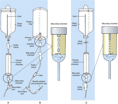 Iv Set Diagram