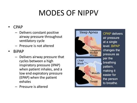 PPT NONINVASIVE POSITIVE PRESSURE VENTILATION NIPPV, 60% OFF