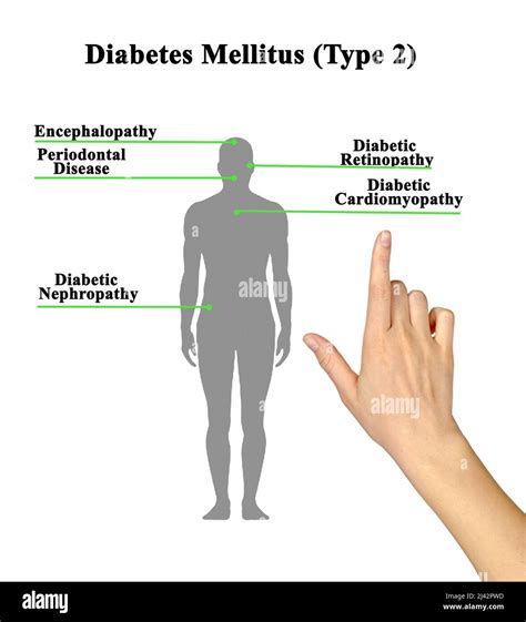 Type Diabetes Diagram Fotos Und Bildmaterial In Hoher Aufl Sung Alamy