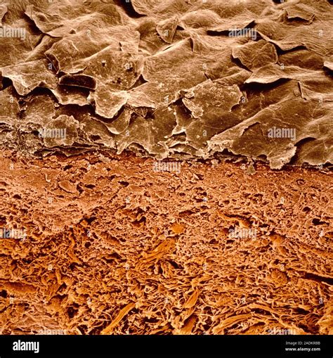 False Colour Scanning Electron Micrograph Of A Section Of Human Skin