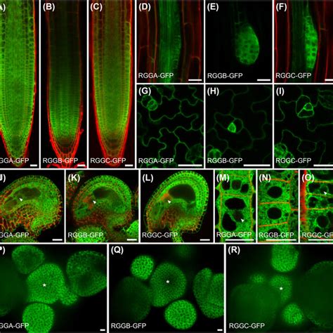 Expression Pattern And Subcellular Localization Of AtRGG GFP Fusion