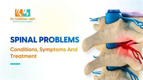 Spinal Problems: Conditions, Symptoms And Treatment