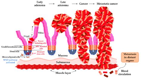 Arise Of Tumor Initiating Cells From Aberrant Colon Crypt And