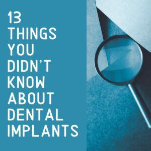 Things You Didn T Know About Dental Implants Chicago Dental Implants