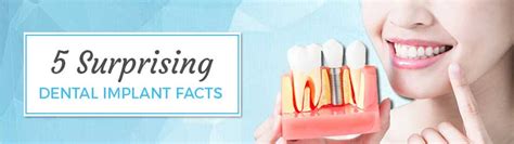 Surprising Dental Implant Facts Atlantic Dental Group