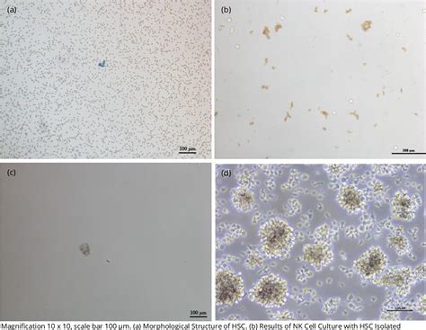 Figure 1 From Comparison Of Maturation Stages Of Natural Killer Cell