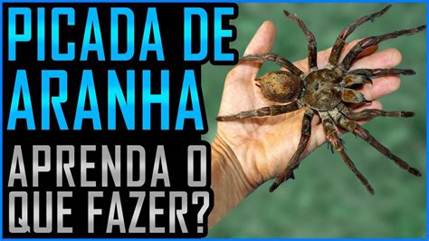 Picada De Aranha Como Identificar Como Tratar E Sintomas