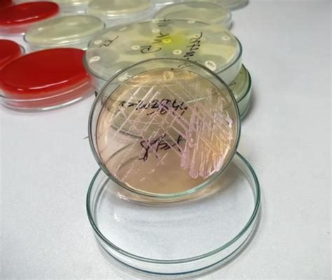 Bacterial Culture Stock Photos, Images and Backgrounds for Free Download