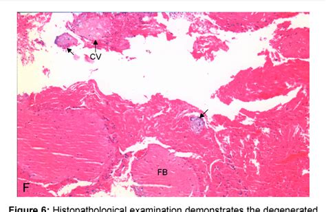 [pdf] Value Of Serial Ultrasounds In Early Diagnosis And Management Of