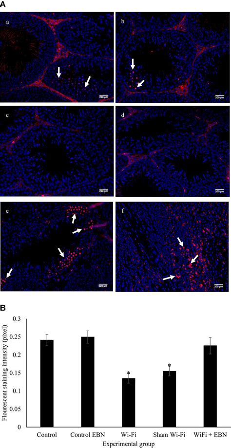 A Immunofluorescence Staining On Sections Of The Testis For The