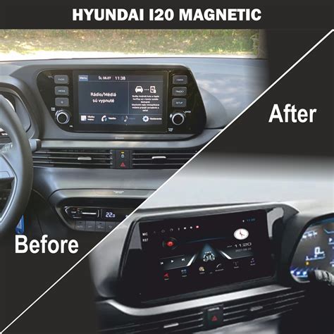 Hyundai I Magnetic Touch Screen Android Music System