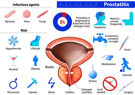 Prostatitis Prostate Specialist Consultant In Sussex The Sussex