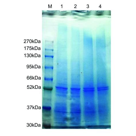 | Sodium dodecyl sulfate-polyacrylamide gel electrophoresis 12% ...