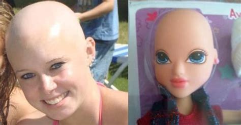 Bald and Beautiful Barbie Campaign. I'm A Barbie Girl, Good Job, Balding, Beautiful Dolls ...