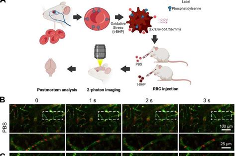 New study is first to find brain hemorrhage cause other than injured blood vessels