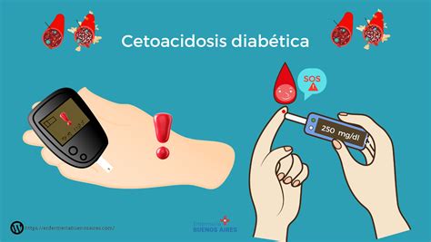 Cetoacidosis Diabética Cuidados De Enfermería 2023