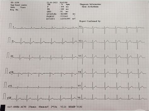 » Electrocardiogram