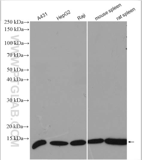 Beta 2 Microglobulin Polyclonal Antibody 13511 1 Ap