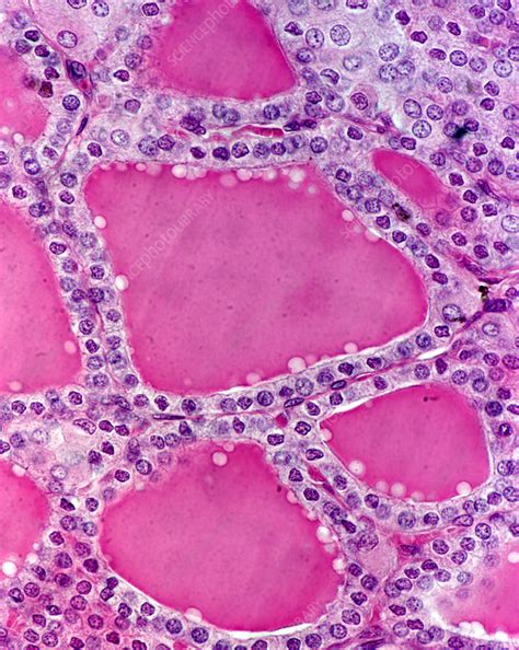 Thyroid Gland Follicles - Stock Image - P750/0129 - Science Photo Library