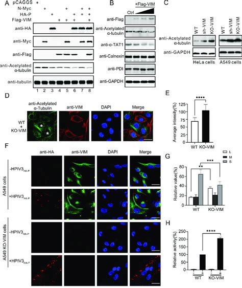 Vim Negatively Regulates The Acetylation Of α Tubulin Inhibiting The