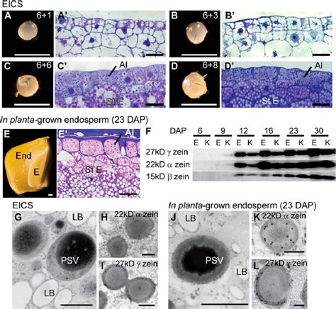 Structural Features Of Aleurone And Starchy Endosperm Cells A To D