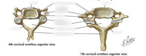 Diagram Of Cervical Vertebra Bony Landmarks Quizlet