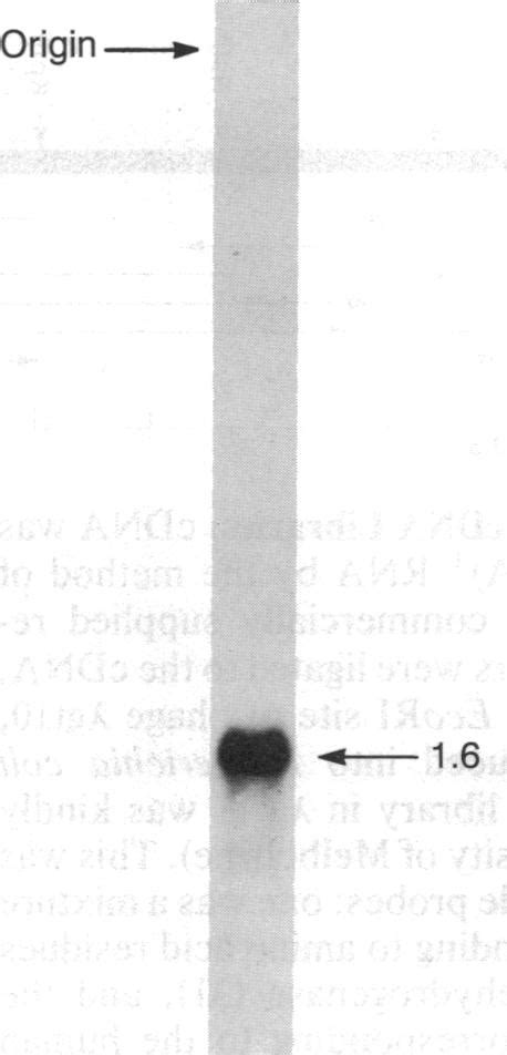 Northern Blot Of Baboon Liver Mrna Probed With 32p Labeled Baboon