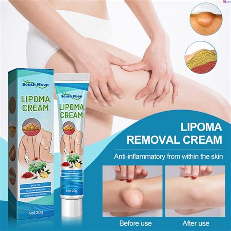 South Moon Lipoma Removal Ointment Fatty Cellulite Cream 20g Lipoma