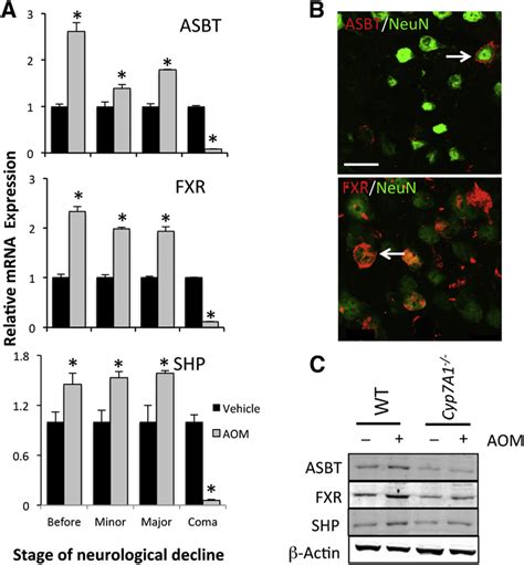 Farnesoid X Receptor FXR Signaling Is Elevated In Brain During Acute