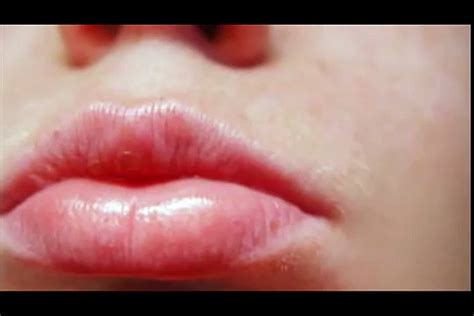 Como Quitar Lo Hinchado De Los Labios Aromapic