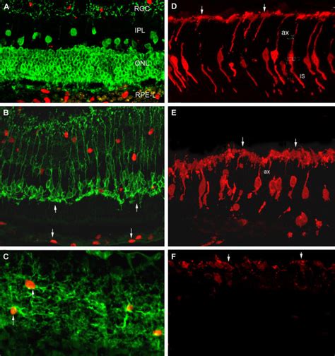 Transplanted Human Neural Progenitors Express Nestin In Vivo And