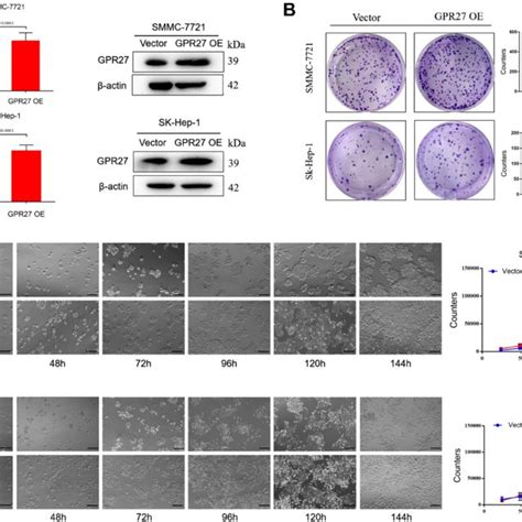 Knockdown Of Gpr Induces S Phase Arrest In Hcc Cells A Cell Cycle