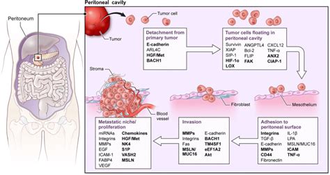 The Metastatic Cascade Of Peritoneal Metastasis Showing The Major