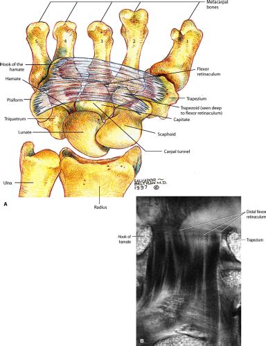 The Wrist And Hand Musculoskeletal Key