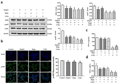 Omp31 Rapamycin and 3 MA inhibit the activation of the NF κB p65