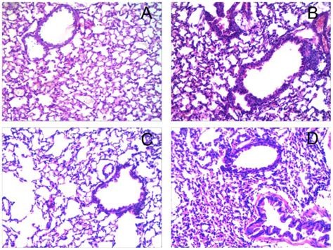 Intranasal Instillation Of Mir Targeting Il Il Attenuates