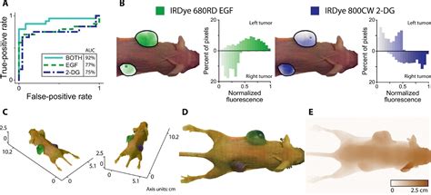 Hexachromatic Bioinspired Camera For Image Guided Cancer Surgery