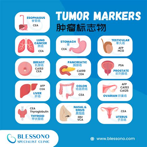 Understanding The Importance Of Tumor Markers Blood Test Malaysia