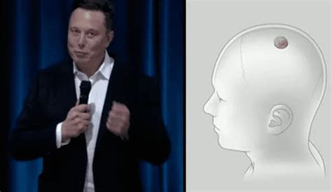 Multimillonario Elon Musk Revela último Avance De Neuralink Un Chip