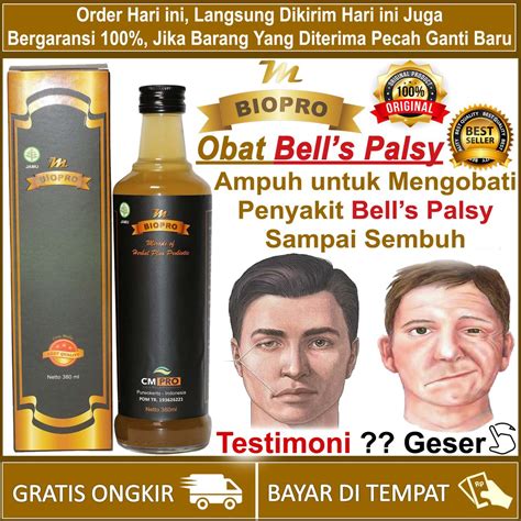 Jual Obat Bells Palsy Paling Ampuh Mulut Miring Sebelah Lumpuh Wajah